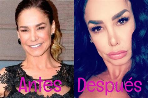 lis vega antes|El increíble antes y después de Lis Vega en candentes fotos